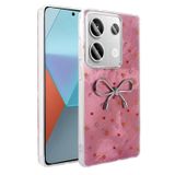 Xiaomi Redmi Note 13 Pro 4G Kılıf Kamera Korumalı Figürlü Zore Ponti Silikon Kapak