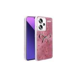 Xiaomi Redmi Note 13 Pro Plus 5G Kılıf Kamera Korumalı Figürlü Ponti Silikon Kapak Açık Pembe