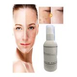 Xlan White Factor Cilt Beyazlatıcı Ton Açıcı Krem 120 Ml