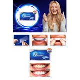 xolo 12 Adet Diş Beyazlatma Bandı 3D White Professional Effects Diş Beyazlatma Bantları 8133458903555