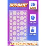 Xolo Maksimum Sos Bant 36 Adet Xl