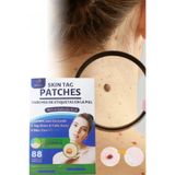xolo Skin Tag Remover 88 Adet Leke Karşıtı Dökücü Yokedici Bant Sıgıl Et Beni Giderici