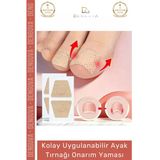 #Yarabandı Kolay Uygulanabilir Mantar Karşıtı Sararma Giderici Bakım Ayak Tırnağı Onarım Yaması