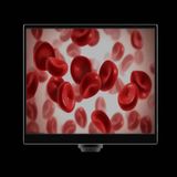 YW5612 11.6 İnç Hepsi Bir Arada Mikroskop Kamerası - 5MP 1080P@60FPS HDMI & USB Entegre Monitörlü Dijital Mikroskop Ekranı