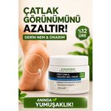 zinderm Ayak ve Topuk Çatlak Kremi 125ML | Ayak Bakım Kremi | Topuk Kremi | Yoğun Nemlendirici, Yumuşatıcı Topuk Çatlağı Kremi 125ML
