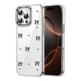 Zipax Apple İphone 16 Pro Max İle Uyumlu Kılıf Desenli Silikon Kapak Azn Fiyonk Siyah