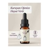 Zoe OJE ÇÖZÜCÜ