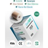 Zone Tape Soft Silikon Bant 4 x 1.5 mt - Estetik - Karın Kol Bacak Germe- Ben Aldırma - Ten