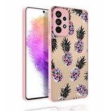 Zore Galaxy A73 Desenli Kamera Korumalı Parlak Nora Kılıf