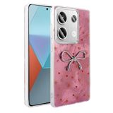 Zore Xiaomi ile uyumlu Redmi Note 13 Pro 4G Kılıf Kamera Korumalı Figürlü Zore Ponti Silikon Kapak Açık Pembe