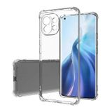 Zore Xiaomi Mi 11 Lite Kamera Korumalı Nitro Anti Shock Silikon