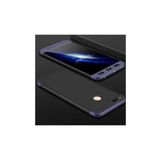 Zore Xiaomi Mi 5X Ays Kılıf
