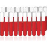 Zürih Ticaret ZURIHLAB Cam Deney Tüpü (16x100 mm) - 20 Adetlik Set - Hacim: 12 mL - Isıya Dayanıklı