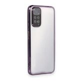 BSSM Razer Lensli Silikon - Mor Xiaomi Redmi Note 11 Kılıf