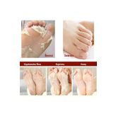 Çorap Tipi Ayak Peeling Maskesi