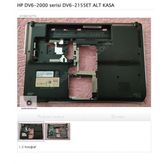 Hp Dv6-2000 Serisi Dv6-2155Et Alt Kasa