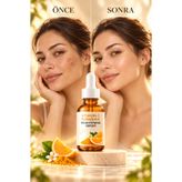 Puredermine Güçlü Etki & Vitamin C & Zerdeçal İçeren Güçlü Serum ile Lekeleri Azaltın, Gözenekleri Sıkılaştırın, Akne Görünümünü Yatıştırın