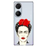 Senada Reeder S19 Max Pro S Edge İle Uyumlu Kılıf Silikon Desenli Kapak Xfridax