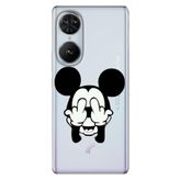 Senada Reeder S19 Max Pro S Edge İle Uyumlu Kılıf Telefon İle Uyumlu Kılıfı Baskılı Mickeyyyyy Karakter