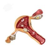 Uterus Pelvik Taban Maketi Model 41