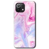 Xiaomi Mi 11 Lite Hd Desen Baskılı Kabarmış Leke Arka Kapak Kılıf
