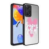 Zore Xiaomi Redmi Note 11 Pro 5G Aynalı Desenli Kamera Korumalı Parlak Mirror Cep Telefonu Kılıfı