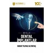 50 Soruda Dental İmplantlar Nuray Yılmaz Altıntaş