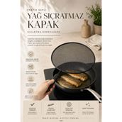 Anadolu Saray Pratik Saplı Yağ Sıçratmaz Kapak Kızartma Koruyucu Mutfak Filesi - 1 ADET