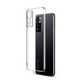 Newface Xiaomi Redmi Note 11 Pro Plus 5G Lüx Şeffaf Silikon Cep Telefonu Kılıfı