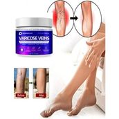 Süper Maximum Strength Varicose Vein Var.is Bacak Bakım Masaj Kremi 100 ml 2 Adet - 1li