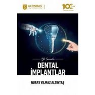 50 Soruda Dental İmplantlar Nuray Yılmaz Altıntaş