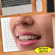 55945 Dentist Diş Hekimi Sağlıklı Dişler 240 Parça Puzzle Yapboz