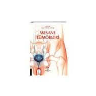 Akademisyen Kitabevi Mesane Tümörleri