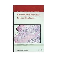 Biyopsilerin Yorumu Frozen İnceleme - Jerome B. Taxy Aliya N. Husain Anthony G. Montag