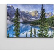 Dekolata Çamlar ve Göl 70x100 cm Kanvas Tablo