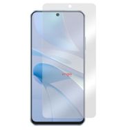 Engo Huawei Nova 13i Mat Parmak İzi Bırakmaz Ekran Koruyucu