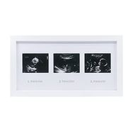 Fufizu 3'lü Bebek Ultrason Anı Çerçevesi