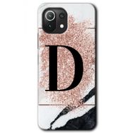 Gramaphone Mi 11 Lite Hd Desen Baskılı Arka Kapak Pembe Mermer Desenli D Harfi Kılıf