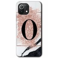 Gramaphone Mi 11 Lite Hd Desen Baskılı Arka Kapak Pembe Mermer Desenli O Harfi Kılıf