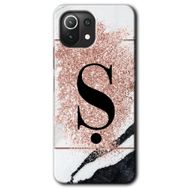 Gramaphone Mi 11 Lite Hd Desen Baskılı Arka Kapak Pembe Mermer Desenli S Harfi Kılıf