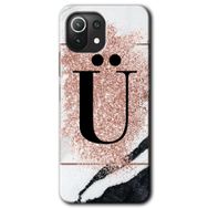 Gramaphone Mi 11 Lite Hd Desen Baskılı Arka Kapak Pembe Mermer Desenli U Harfi Kılıf