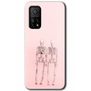 Gramaphone Xiaomi Mi 10T Pro Kılıf HD Desen Baskılı Arka Kapak - Yaşayan Çift Kılıf