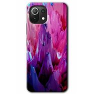 Gramaphone Xiaomi Mi 11 Lite Kılıf HD Desen Baskılı Arka Kapak - Abstraction Sharp Kılıf