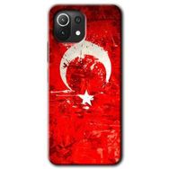 Gramaphone Xiaomi Mi 11 Lite Kılıf HD Desen Baskılı Arka Kapak - Albayrak 2 Kılıf