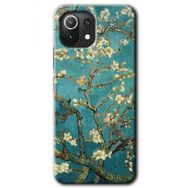 Gramaphone Xiaomi Mi 11 Lite Kılıf HD Desen Baskılı Arka Kapak - Almond Blossom Kılıf