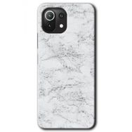 Gramaphone Xiaomi Mi 11 Lite Kılıf HD Desen Baskılı Arka Kapak - Art Design 28 Kılıf