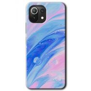Gramaphone Xiaomi Mi 11 Lite Kılıf HD Desen Baskılı Arka Kapak - Art Design 38 Kılıf