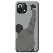 Gramaphone Xiaomi Mi 11 Lite Kılıf HD Desen Baskılı Arka Kapak - Artwork Wide Kılıf