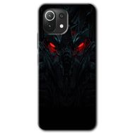 Gramaphone Xiaomi Mi 11 Lite Kılıf HD Desen Baskılı Arka Kapak - Blur Lights Kılıf