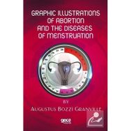 Graphic Illustrations Of Abortion And The Diseases Of Menstruation Augustus Bozzi Granville-Gece Kitaplığı